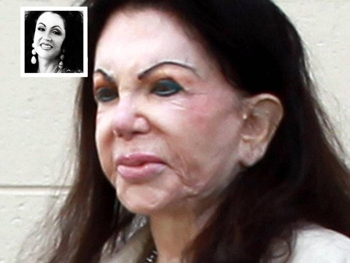 Cirugía estética: antes y después Jackie Stallone