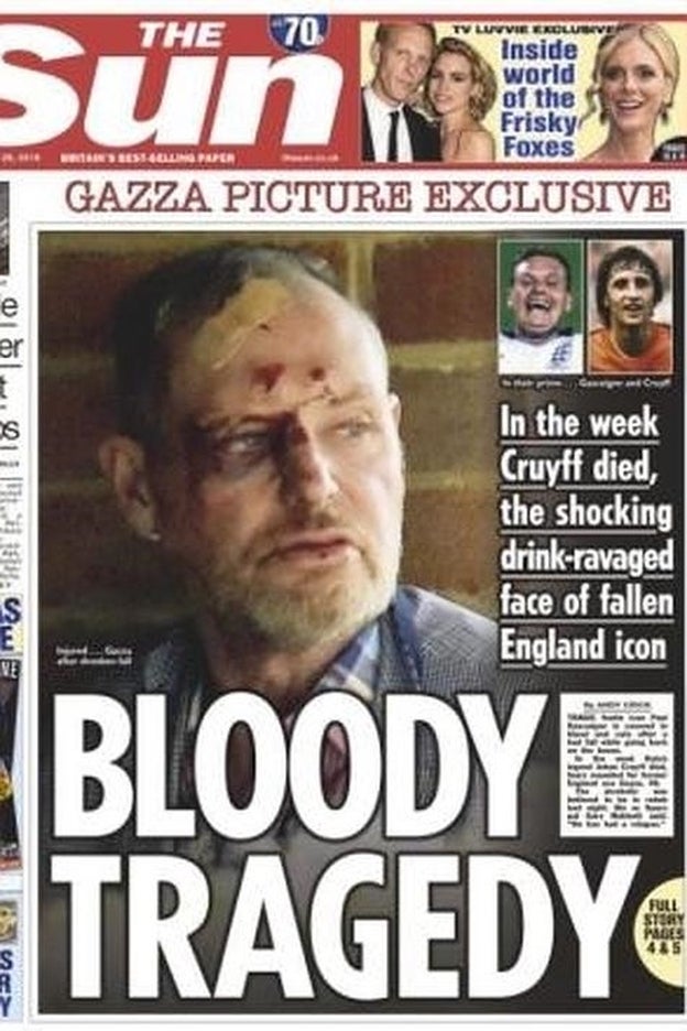 Esta es la portada de 'The Sun' en la que vemos a un Gascoine muy deteriorado y con la cara llena de sangre./the sun.