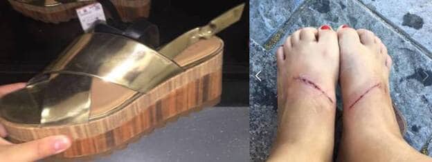 Una chica denuncia heridas causadas por unas sandalias de Zara... y se hace viral