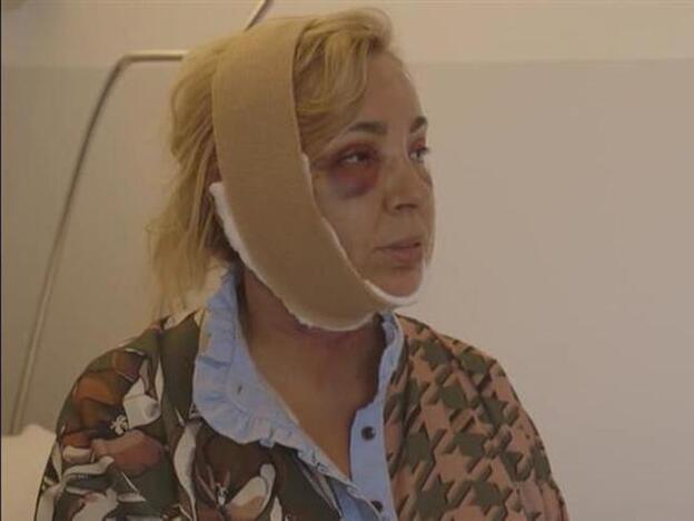 Carmen Borrego en la primera imagen tras su operación de papada.