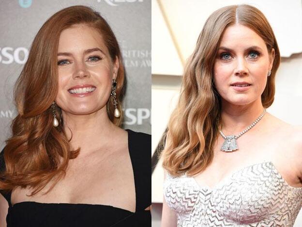 Los expertos nos dan todas las claves del antes y después del rostro de Amy Adams.