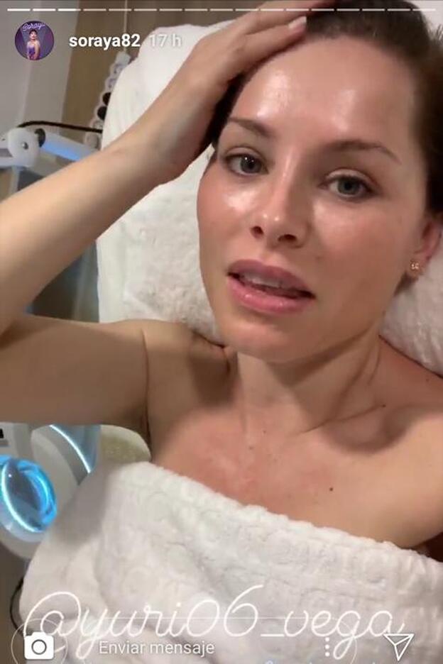 Soraya Arnelas ha explicado los detalles de este nuevo tratamiento facial en algunos de sus recientes 'stories' de Instagram.