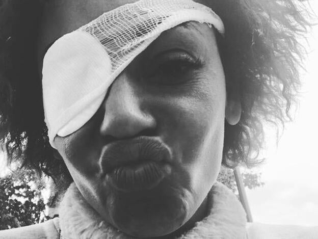 Mel B posa con su parche y explica qué le ha pasado en los ojos para zanjar los rumores de la prensa. Pincha sobre la foto para ver los famosos que han sufrido 'buylling'./instagram.